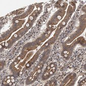 Anti-NECTIN1 antibody produced in rabbit Prestige Antibodies&#174; Powered by Atlas Antibodies, affinity isolated antibody, buffered aqueous glycerol solution