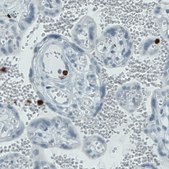 Monoclonal Anti-MMP9 antibody produced in mouse Prestige Antibodies® Powered by Atlas Antibodies, clone CL0542, purified immunoglobulin, buffered aqueous glycerol solution