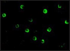 Anti-NOD2 (ab2) antibody produced in rabbit affinity isolated antibody, buffered aqueous solution