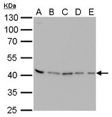 Monoclonal Anti-PRMT1 antibody produced in mouse clone GT10111, affinity isolated antibody