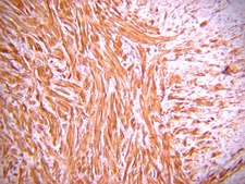 Anti-Collagen Type VI Antibody, clone VI-26 clone VI-26, Chemicon&#174;, from mouse