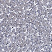 Anti-METTL4 antibody produced in rabbit Prestige Antibodies&#174; Powered by Atlas Antibodies, affinity isolated antibody, buffered aqueous glycerol solution