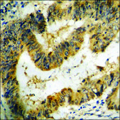 Anti-phospho-Telomerase (pSer824) antibody produced in rabbit affinity isolated antibody