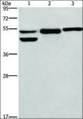 Anti-GPER1 antibody produced in rabbit affinity isolated antibody