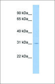 Anti-GCLM antibody produced in rabbit affinity isolated antibody