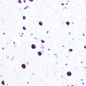 Anti-MITF antibody produced in rabbit