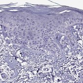 Anti-NKX3-1 Prestige Antibodies&#174; Powered by Atlas Antibodies, affinity isolated antibody