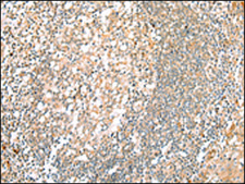 Anti-HTR2A affinity isolated antibody