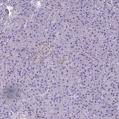Anti-PDE2A antibody produced in rabbit Prestige Antibodies® Powered by Atlas Antibodies, affinity isolated antibody, buffered aqueous glycerol solution