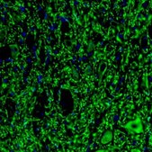 Anti-MAP2 antibody produced in rabbit Prestige Antibodies&#174; Powered by Atlas Antibodies, affinity isolated antibody, buffered aqueous glycerol solution