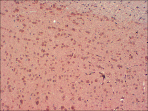 Monoclonal Anti-KCNA4 antibody produced in mouse clone S13-31, 1&#160;mg/mL, purified immunoglobulin
