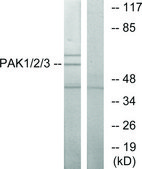 Anti-PAK1 antibody produced in rabbit affinity isolated antibody