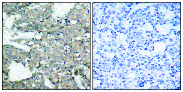 Anti-MAP2K1 (Ab-221) antibody produced in rabbit affinity isolated antibody