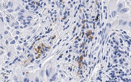 Anti-uPAR Antibody, clone 2G10 , ZooMAb&#174; Rabbit Monoclonal recombinant, expressed in HEK 293 cells