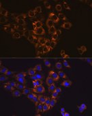 Anti-Caspase-6 Antibody, clone 6D7S2, Rabbit Monoclonal