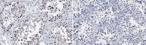 Anti-HSP90 Antibody clone D7a, Upstate&#174;, from mouse
