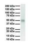 Anti-PIAS2 (AB1) antibody produced in rabbit affinity isolated antibody