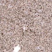 Monoclonal Anti-EZH2 antibody produced in mouse Prestige Antibodies® Powered by Atlas Antibodies, clone CL11960, purified immunoglobulin, buffered aqueous glycerol solution