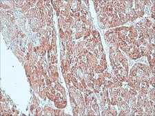 Anti-Superoxide Dismutase (MnSOD) (DD-17) antibody produced in rabbit affinity isolated antibody, buffered aqueous solution