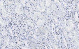 Anti-Angiotensinogen Antibody, clone 1B12 ZooMAb&#174; Rabbit Monoclonal recombinant, expressed in HEK 293 cells