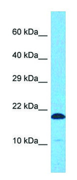 Anti-EIF5A (C-terminal) antibody produced in rabbit affinity isolated antibody