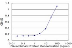 Monoclonal Anti-S100A7 antibody produced in mouse clone 2A10, purified immunoglobulin, buffered aqueous solution