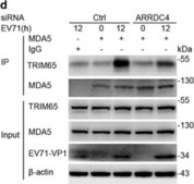 Anti-TRIM65 antibody produced in rabbit Prestige Antibodies&#174; Powered by Atlas Antibodies, affinity isolated antibody, buffered aqueous glycerol solution, Ab2