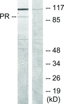 Anti-Progesterone Receptor antibody produced in rabbit affinity isolated antibody