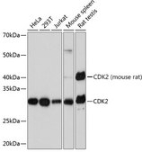[KO Validated]Anti-CDK2 Antibody, clone 10E0N5, Rabbit Monoclonal