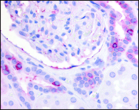 Anti-PTGER2 (AB4) antibody produced in rabbit affinity isolated antibody, buffered aqueous solution