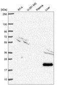 Anti-Tagln Antibody Produced In Rabbit Prestige Antibodies® Powered by Atlas Antibodies, affinity isolated antibody, buffered aqueous glycerol solution