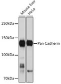 Anti-Pan Cadherin Antibody, clone 6N5P8, Rabbit Monoclonal
