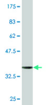 Monoclonal Anti-EVC antibody produced in mouse clone 3C4, purified immunoglobulin, buffered aqueous solution