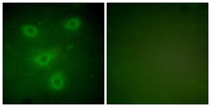 Anti-Keratin 14 antibody produced in rabbit affinity isolated antibody