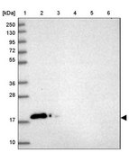 Anti-CALM1 antibody produced in rabbit Prestige Antibodies&#174; Powered by Atlas Antibodies, affinity isolated antibody, buffered aqueous glycerol solution