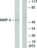 Anti-MMP-3 antibody produced in rabbit affinity isolated antibody