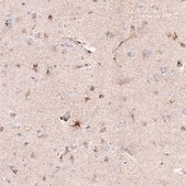 Monoclonal Anti-CHI3L1 antibody produced in mouse Prestige Antibodies® Powered by Atlas Antibodies, clone CL12241, purified immunoglobulin, buffered aqueous glycerol solution