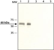 Anti-Calsequestrin-1 antibody produced in rabbit ~1.6&#160;mg/mL, affinity isolated antibody, buffered aqueous solution