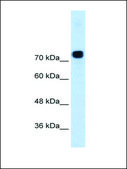 Anti-ACTN4 (AB2) antibody produced in rabbit IgG fraction of antiserum