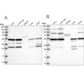 Anti-PDHX antibody produced in rabbit Prestige Antibodies&#174; Powered by Atlas Antibodies, affinity isolated antibody, buffered aqueous glycerol solution