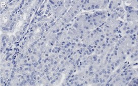 Anti-RBPJ Antibody, clone 2D10 ZooMAb&#174; Rabbit Monoclonal recombinant, expressed in HEK 293 cells