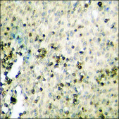 Anti-phospho-C-RAF (pSer296) antibody produced in rabbit affinity isolated antibody