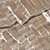 Anti-KEAP1 antibody produced in rabbit Prestige Antibodies® Powered by Atlas Antibodies, affinity isolated antibody, buffered aqueous glycerol solution