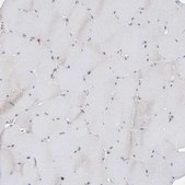 Anti-P2RY10 antibody produced in rabbit Prestige Antibodies® Powered by Atlas Antibodies, affinity isolated antibody, buffered aqueous glycerol solution