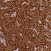 Anti-PVALB antibody produced in rabbit Prestige Antibodies&#174; Powered by Atlas Antibodies, affinity isolated antibody, buffered aqueous glycerol solution