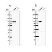 Anti-TGM2 antibody produced in rabbit Prestige Antibodies&#174; Powered by Atlas Antibodies, affinity isolated antibody, buffered aqueous glycerol solution