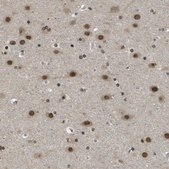 Anti-KAT5 antibody produced in rabbit Prestige Antibodies® Powered by Atlas Antibodies, affinity isolated antibody, buffered aqueous glycerol solution