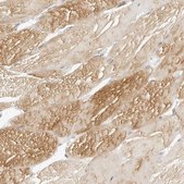 Anti-MYBPC1 antibody produced in rabbit Prestige Antibodies&#174; Powered by Atlas Antibodies, affinity isolated antibody, buffered aqueous glycerol solution