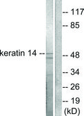 Anti-Keratin 14 antibody produced in rabbit affinity isolated antibody
