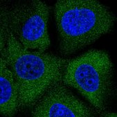 Anti-MAP2K2 antibody produced in rabbit Prestige Antibodies&#174; Powered by Atlas Antibodies, affinity isolated antibody, buffered aqueous glycerol solution
